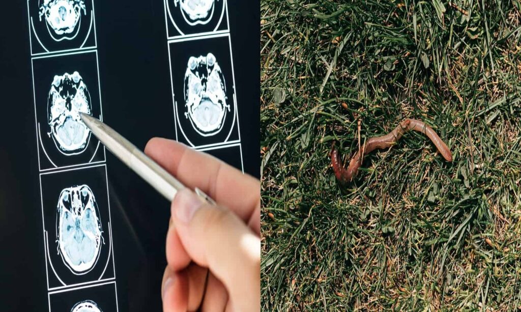 Parasitic Worm Living in Woman's Brain Found in Australia