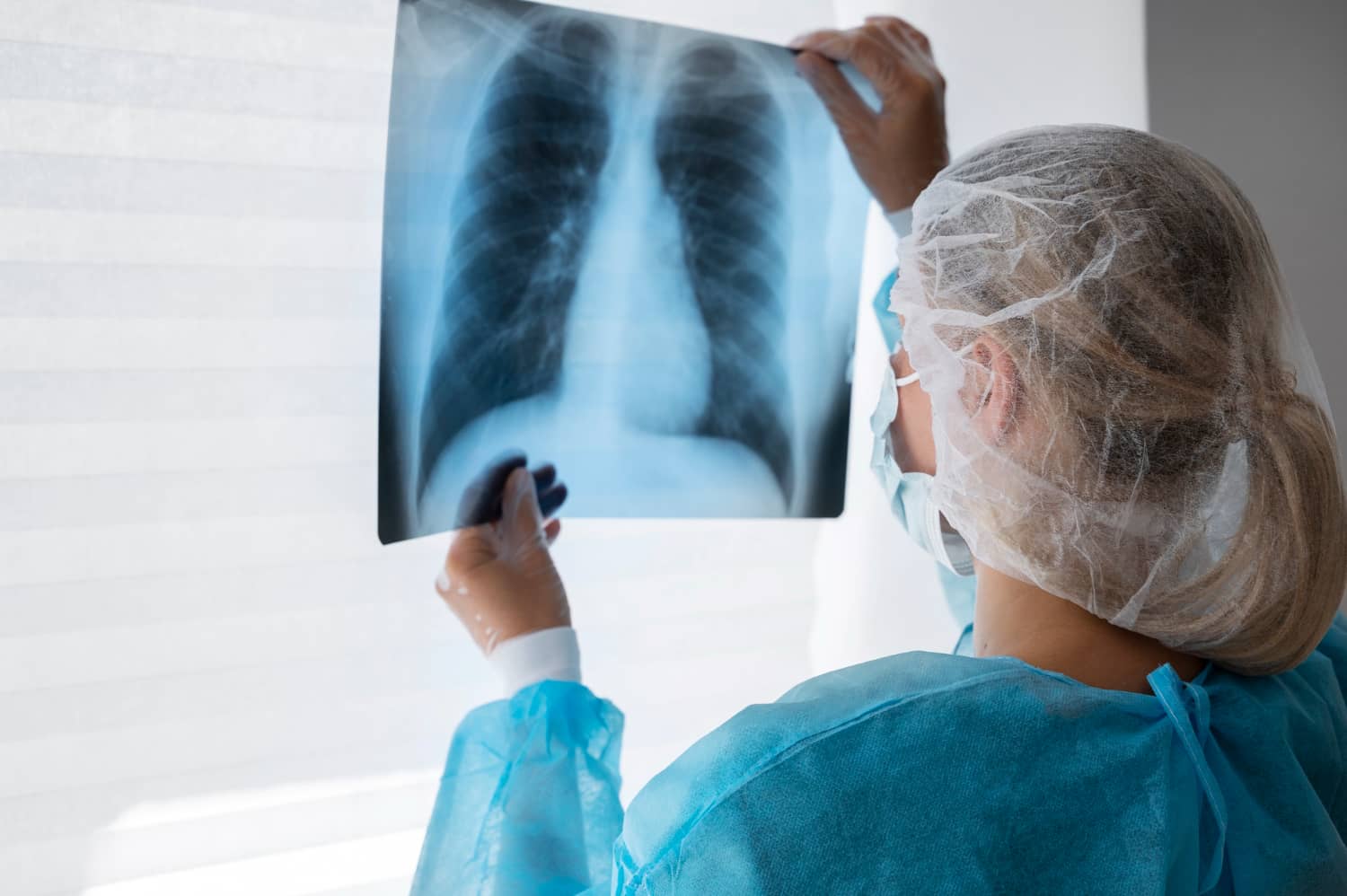 Young Women Become the Main Victims of Lung Cancer: Study