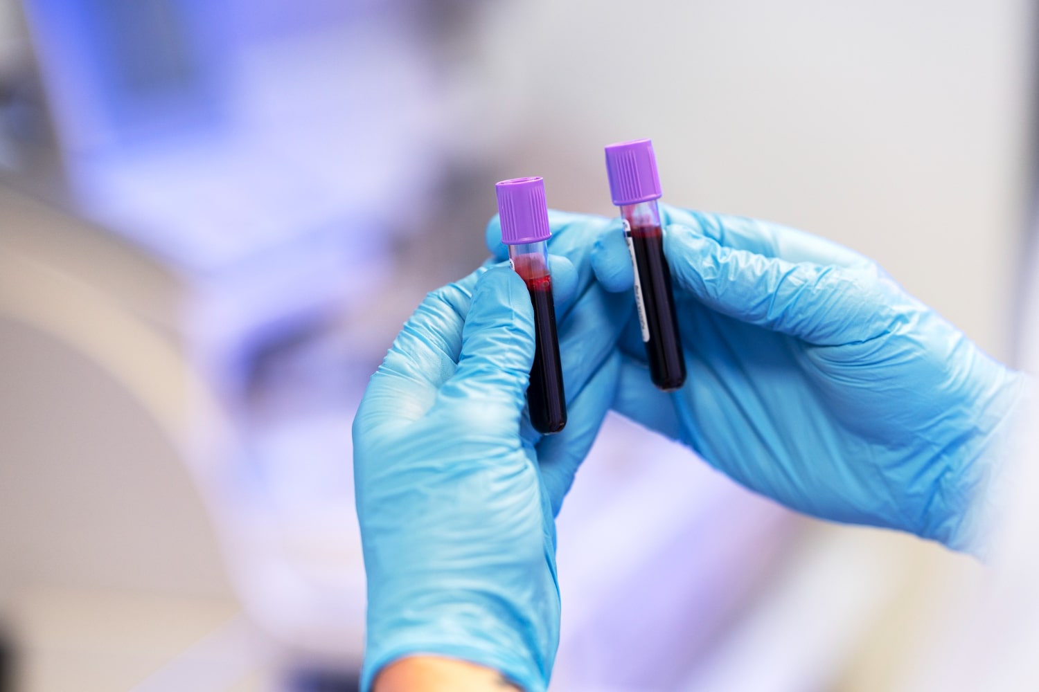 Blood test could help diagnose Parkinson's